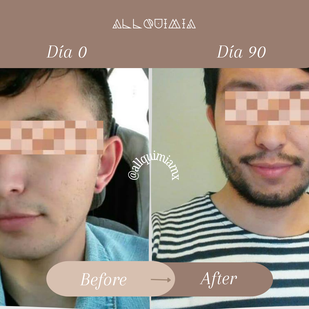 Tónico Para Caballero, Crecimiento de Barba y Cabello